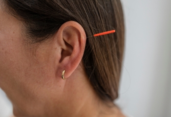 Control del dolor con auriculoterapia en Salamanca