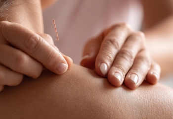 Tratamiento del dolor crónico agudo con acupuntura en Salamanca