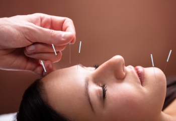 Reducción de arrugas - Acupuntura facial en Salamanca