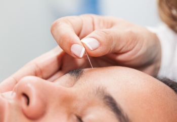 Reducción de manchas - Acupuntura facial en Salamanca