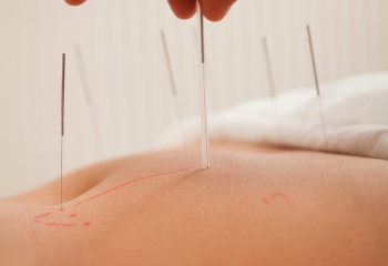 Regulación de ciclo menstrual con acupuntura en Salamanca