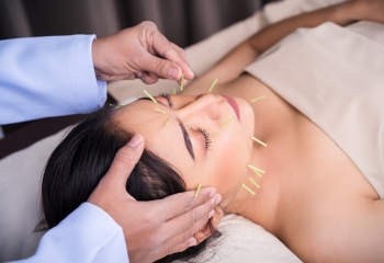 Sustento muscular facial - Acupuntura facial en Salamanca
